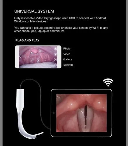 VIDEO LARYNGOSCOPE VIDEO LARYNGOSCOPE